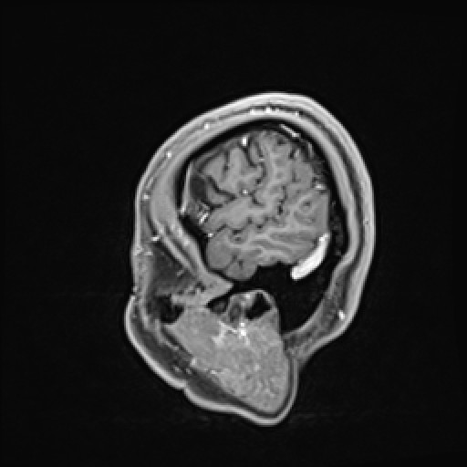 Click on the Serie image to view the images of VILLANUEVA, WILLIAM A.